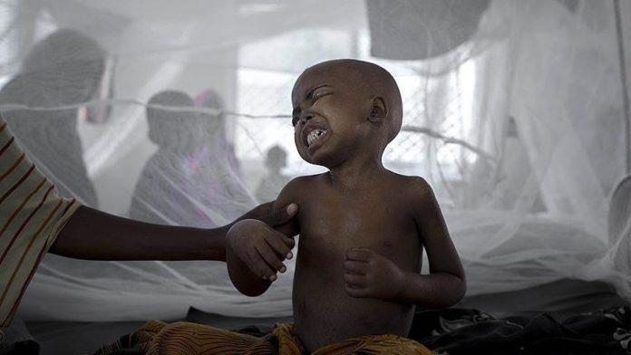 Un cas de Choléra détecté dans ce quartier de Lomé